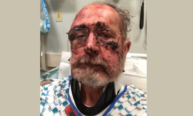 Steve Franklin injuries